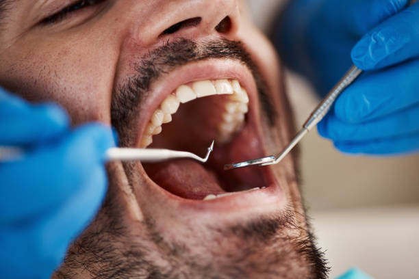 Best Emergency Denture Repair in Agler Estates, FL